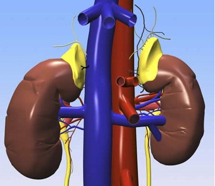 Острый пиелонефрит