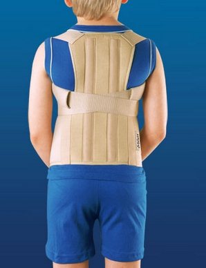 Лечение поясничного лордоза