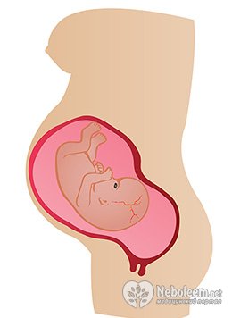 Причины задержки внутриутробного развития плода