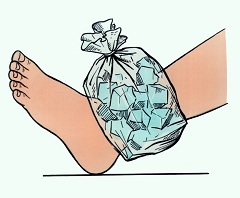 Холодный компресс к поврежденному суставу - обязательное условие первой помощи при вывихе