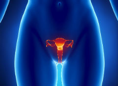 На первой стадии рака эндометрия проводят удаление тела, шейки матки и придатков с двух сторон