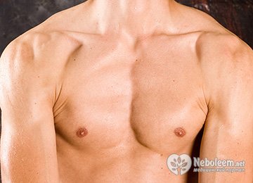 Основные симптомы гинекомастии у мужчин