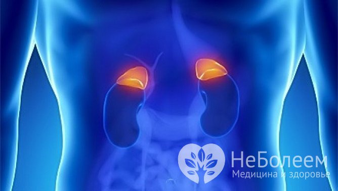 Аддисоническим кризом называется острая недостаточность коры надпочечников