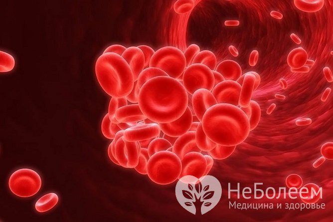 Акушерское кровотечение обычно начинается внезапно, быстро становится массивным и нередко приводит к развитию коагулопатии