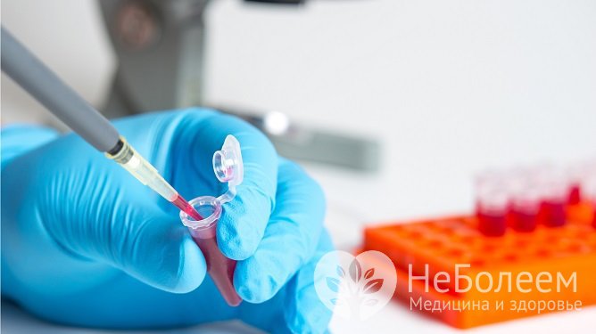 Для выявления возбудителя бытового сифилиса назначают анализы крови, ликвора и отделяемого из язв