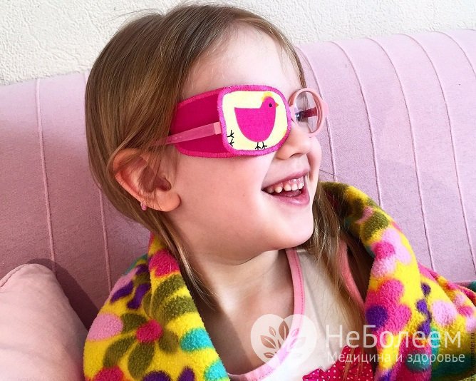 Лечение косоглазия у детей проводится методом окклюзии