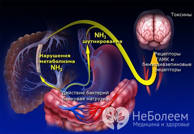 Печеночная энцефалопатия: симптомы и лечение