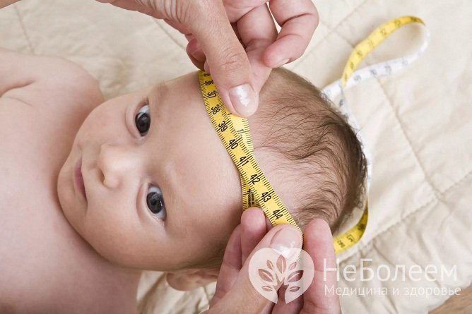 Выбухание родничка у грудничка может свидетельствам о повышенном внутричерепном давлении