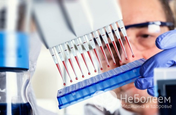 Иммуноферментный анализ (ИФА) позволяет обнаружить в крови антитела к ВИЧ