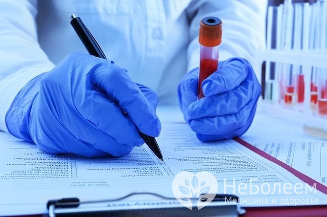 Анализ на прогестерон проводится при исследовании овуляции