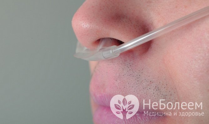 Что такое цианоз? Самые частые причины