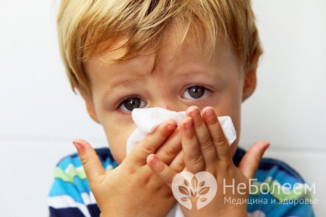 Начальные симптомы ларингита схожи с таковыми при ОРВИ