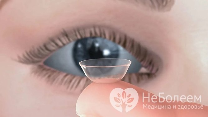 Принцип действия склеральных линз и их отличие от других типов линз